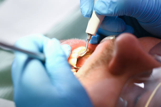 Urgent Tooth Repair in NE