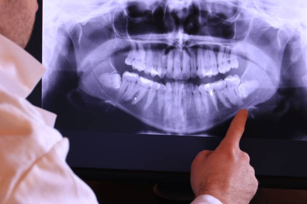 Best Broken Tooth Emergency  in Shelton, NE